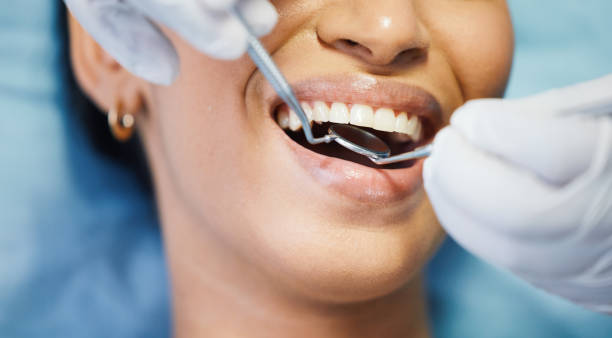 Best Emergency Treatment for Oral Infections in Gig Harbor, WA